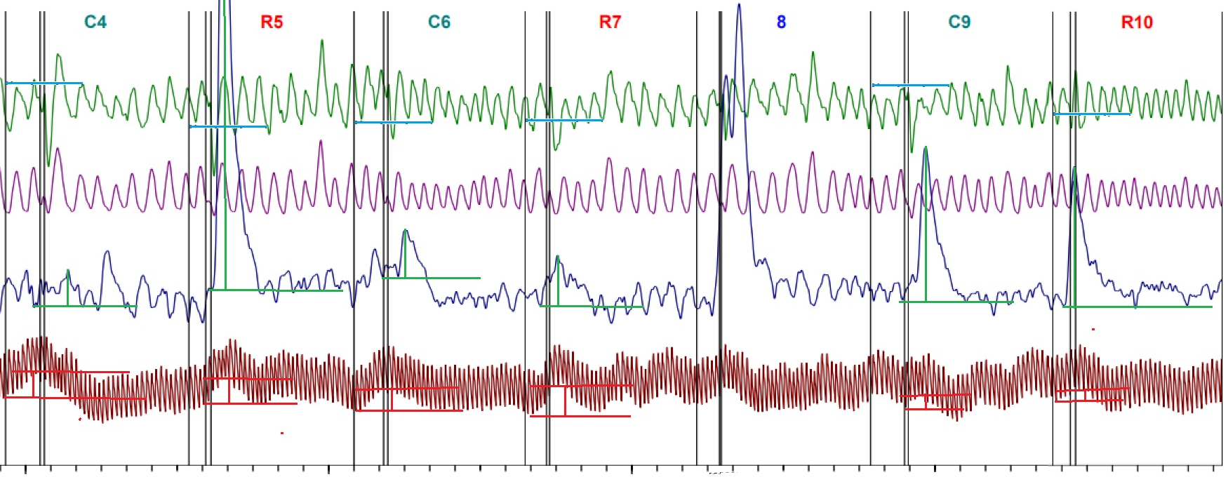 Предъявление 1