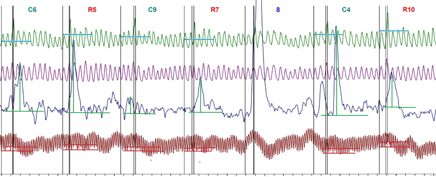 Предъявление 2